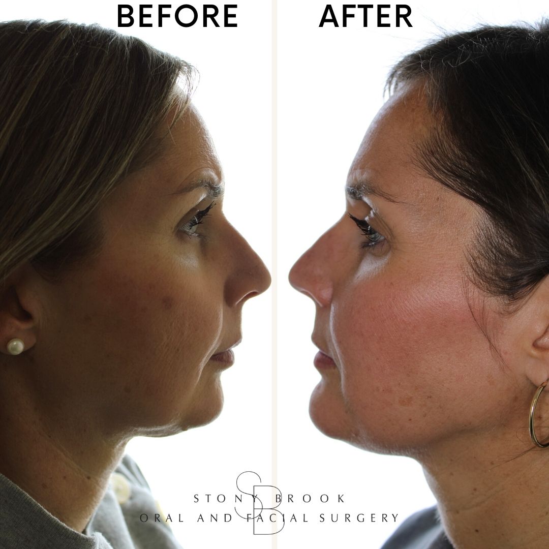 Stony Brook Oral and Facial Surgery